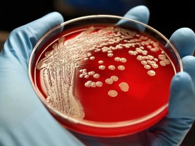 شناسایی یک آنتی‌بیوتیک جدید برای مبارزه با باکتری‌های خطرناک و مقاوم