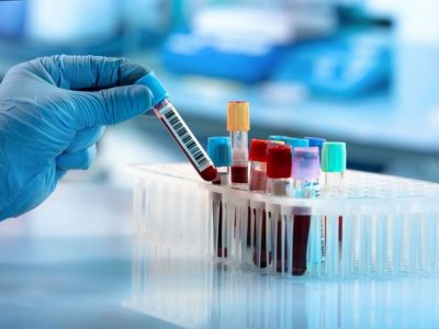 شترها و کوسه‌ها ناجی میلیون‌ها انسان از مرگ حتمی!