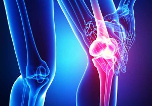 لیست بخور نخورهای مهم برای آرتروز