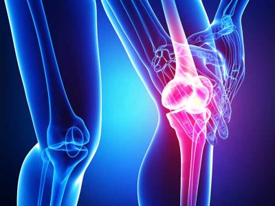 لیست بخور نخورهای مهم برای آرتروز