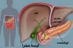 علائم هشداردهنده یک بیماری خاموش