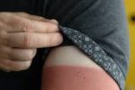 وضعیت خطرناک اشعه ماورای بنفش؛ سلامت پوست و چشم در معرض خطر