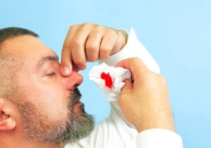 چگونه خون‌دماغ کودکمان را بند بیاوریم