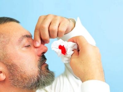 چگونه خون‌دماغ کودکمان را بند بیاوریم