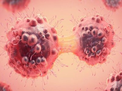 به زودی تشخیص سرطان با هوش مصنوعی امکان پذیر می شود