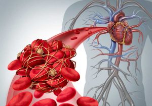 با انجام این آزمایش ساده بفهمید در خطر حمله قلبی هستید یا خیر !