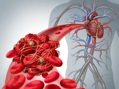 با انجام این آزمایش ساده بفهمید در خطر حمله قلبی هستید یا خیر !