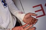 حمله افراد ناشناس به کارشناس اورژانس و وارد کردن خسارت به آمبولانس لالی