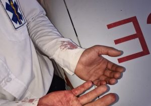 حمله افراد ناشناس به کارشناس اورژانس و وارد کردن خسارت به آمبولانس لالی