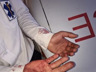 حمله افراد ناشناس به کارشناس اورژانس و وارد کردن خسارت به آمبولانس لالی