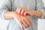 علت خارش شدید پوست و درمان فوری آن چیست؟