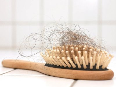 مهمترین دلایل ریزش موهای سر / ریزش چند تار مو در روز طبیعی است؟