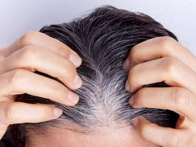 راهکار جلوگیری از خاکستری شدن موها