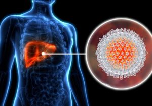 چیزهایی که باید درباره هپاتیت C بدانید