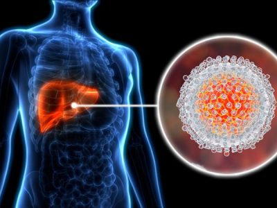 چیزهایی که باید درباره هپاتیت C بدانید
