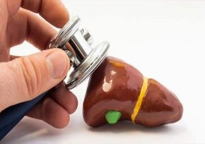 همه چیز درباره سنگ کیسه صفرا؛ چه زمانی به جراحی نیاز داریم؟