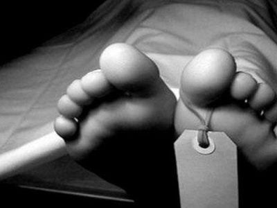 جراحی زیبایی به قیمت جان دختر جوان تمام شد